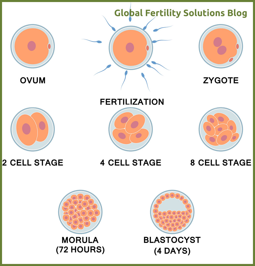 Embryo Quality and Grading - Global Fertility Solutions BlogGlobal ...